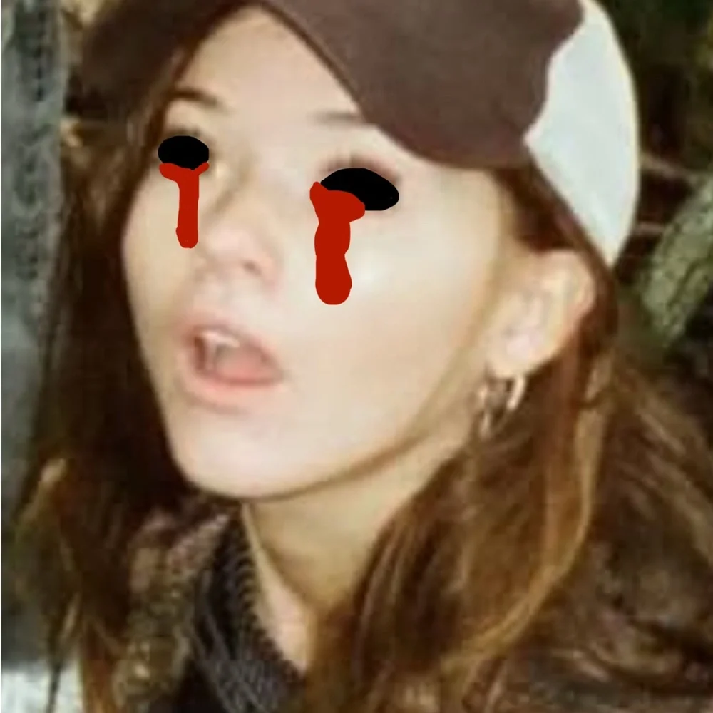 Katie Douglas black eyes with blood